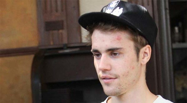 Justin Bieber é celíaco ou alérgico ao gluten?